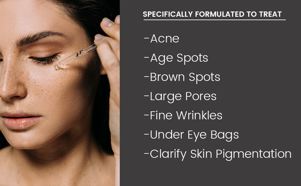 for acne, age spot, brown spots, large pores, fine wrinkles, undereye bags, clarify skin