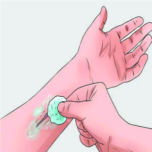 WOUND ANTI BACTERIAL