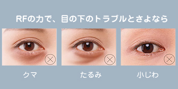 Amazon 目元ケア 美顔器 Rf 目元美顔器 微電流 温熱ケア 高周波 イオン導入 深部熱 フェイスケア 口元ケア リフトアップ クマ改善 ほうれい線 小じわ改善 目の疲れ取り イオン導入器 3dマッサージヘッド 三段階調節 日本語説明書付 プレゼント Kiboer 美顔器 美容