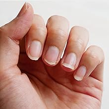 Brittle Nails