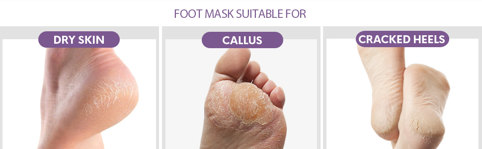 foot mask