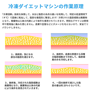 Amazon | 冷凍ダイエットマシン 脂肪冷却 痩身マシン ダイエット