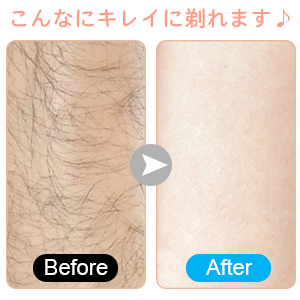 レディスシェーバー