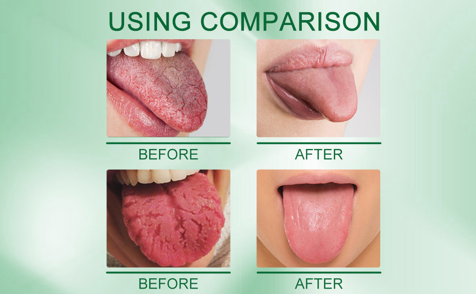 Dioche 3pcs Tongue Repair Spray 30ml Reduce Swelling Tongue