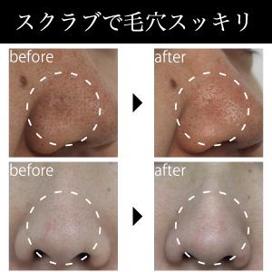 Amazon | リ・ダーマラボ モイストゲルクレンジング 150g | リ