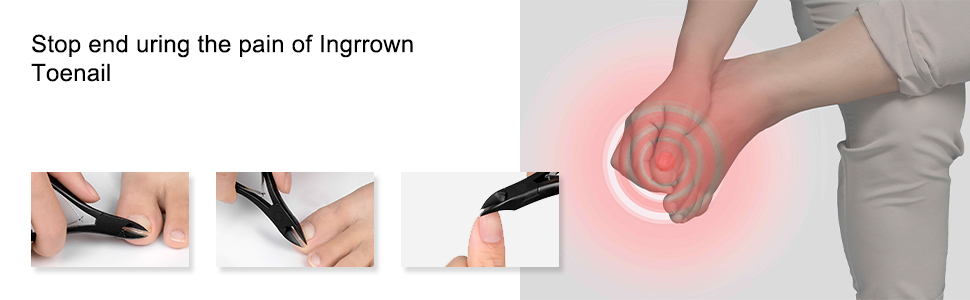 INGROWN TOENAIL CLIPPERS for thick nails thick toenail clipper