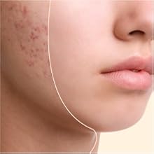 Avocado and Tea Tree Oil 