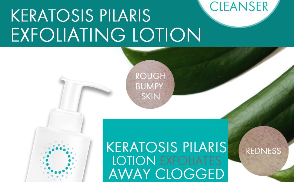 ReTone Keratosis Pilaris Exfoliating Body Lotion KP
