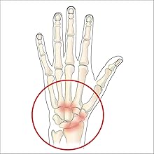 Wrist Arthritis ,Irufa,thumb,wrist,splint,brace,wrap,support,spica,stabilizer,breathable