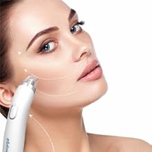 electric blackhead vacuum remover