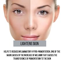 dark spot remover for face,retinol cream for face,retinol cream, retinol serum, retinol hyaluronic