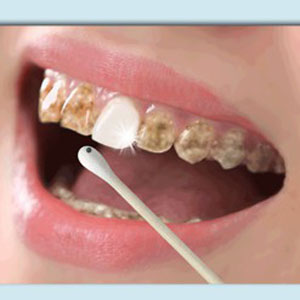 teeth whitening powder