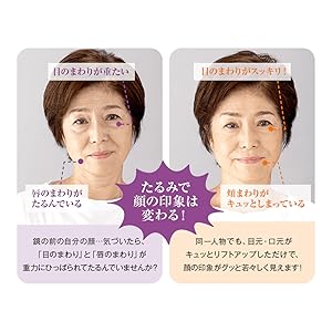 Amazon ヴァーナル リフトアイセラム 15g アイクリーム 目もとケア シワ ハリ たるみ リフトアップ ヒアルロン酸 コラーゲン エラスチン 配合 ヴァーナル 美容液 通販