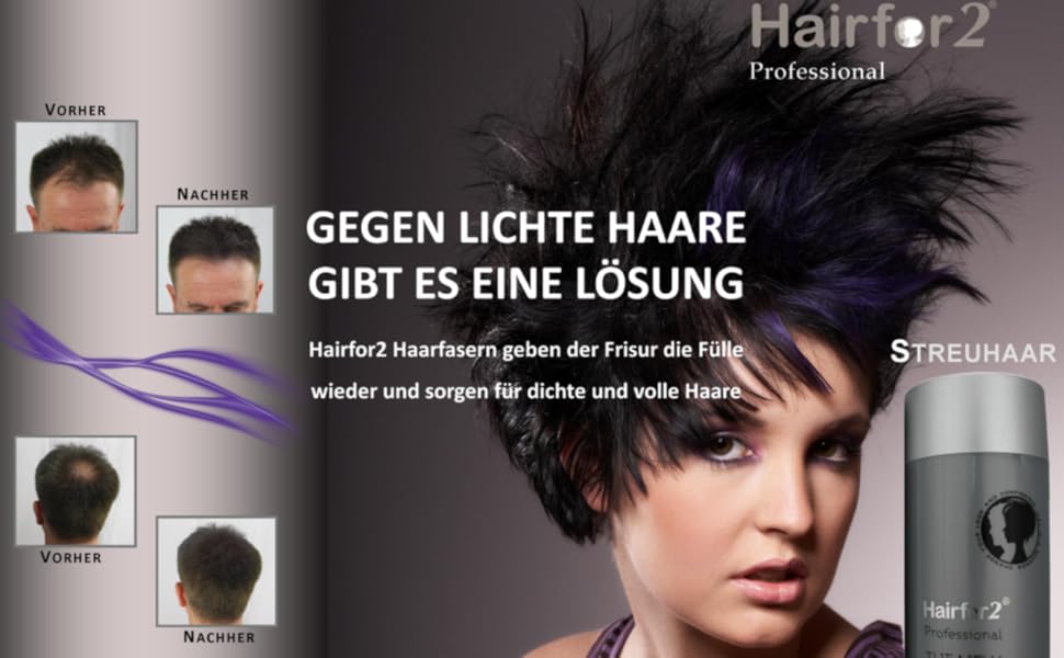 Haaruitval