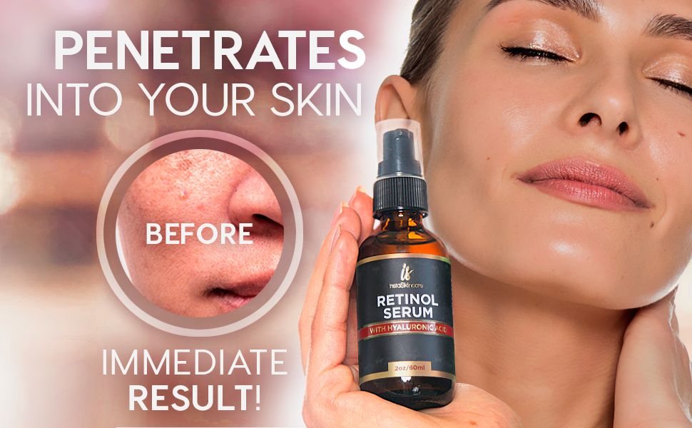 高濃度 レチノール美容液 レチノール 原液 プラセンタ 直営店 ヒアルロン酸 ビタミンa 60ml 目が大きくなりニキビを撃退 ビタミンe 2oz アロエ シワやほうれい線を消して コラーゲン ベラ