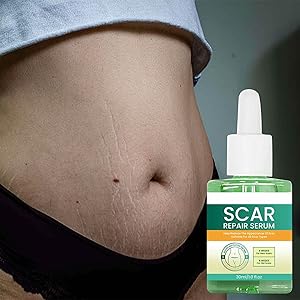 Améliorer le teint de la peau