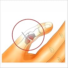 Skier?™s Thumb ,Irufa,thumb,wrist,splint,brace,wrap,support,spica,stabilizer,breathable