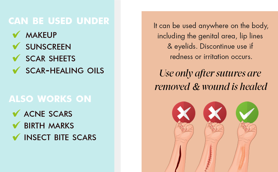 Ebanel Silicone Scar Gel with Onion Extract, Emu Oil