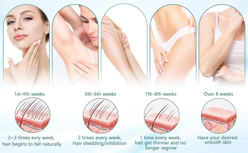 IPL hair removal