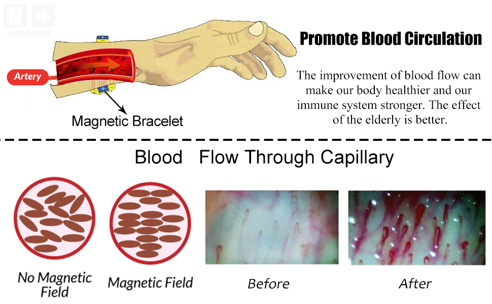 magnetic bracelet