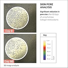 Clinical study result pore volume Nutrova Collagen+Antioxidants