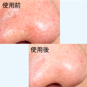 Amazon 毛穴 クレンジングオイル ダブル洗顔不要 メイク落とし 角栓詰り 毛穴の黒ずみに 無添加 97 美容成分 アルガンオイル レチノール ビタミンc 配合 150ml 約2か月分 うる肌うるり クレンジングオイル 通販