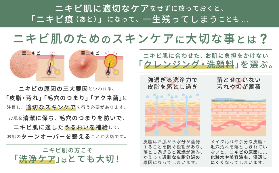 ニキビ洗浄用　OH UI 楽天市場】【公式】ニキビパッチ 32枚入り 薬用 【一般医療機器