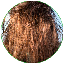 OILY HAIR