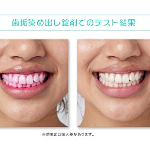 Amazon Ledoc 電動歯ブラシ 青色led 回転式 1万回転 口臭ケア 歯垢除去 ホワイトニング Ledoc 電動歯ブラシ 通販