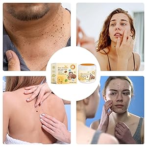 Restores Youthful Skin