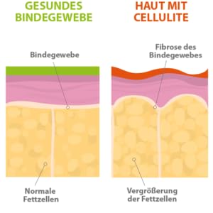 FürstenMED® Bindegewebe Kapseln   Straffe Haut, Anti Cellulite ...