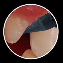 Men's Dental Eraser