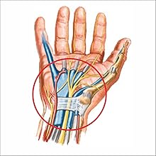 Carpal Tunnel Syndrome ,Irufa,thumb,wrist,splint,brace,wrap,support,spica,stabilizer,breathable