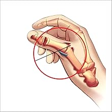 Game Keeper?™s Thumb ,Irufa,thumb,wrist,splint,brace,wrap,support,spica,stabilizer,breathable