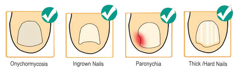 nail clippers for thick toenails finger nail clipper toenail nipper