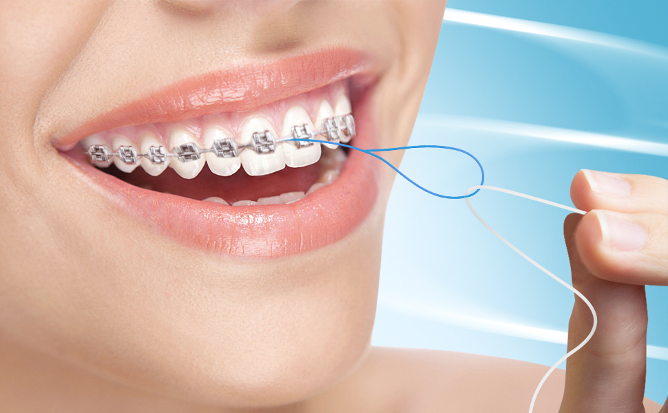 Floss Threaders for Braces, Bridges, and Implants 200 Count