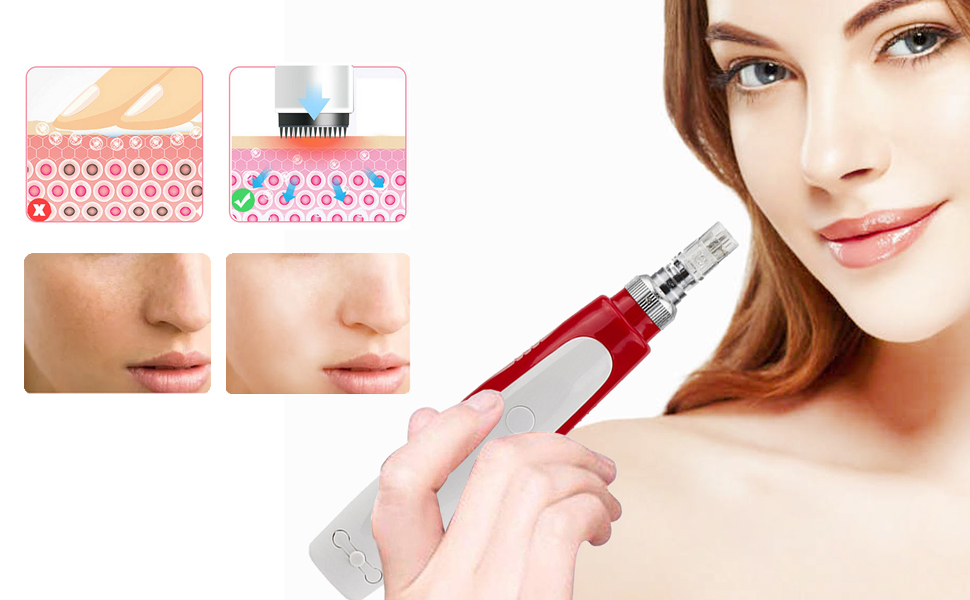 PIPM Microneedling Pen Wireless Electric Tool Dermapen Machine 36Pin Replacement Cartridge Ultima N2