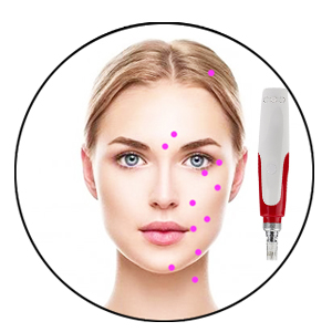 Ultima N2 Professional Microneedling Pen
