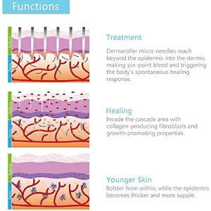 Derma Roller Medical Titanium Needles 540, 0.20mm