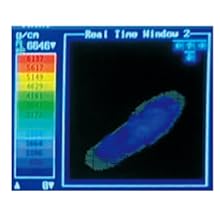 足圧測定器による計測画像