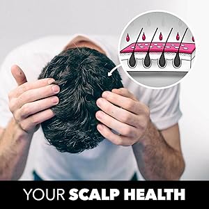 dryscalp;itchy scalp;tgel;polytar;Neutrogena;itchy scalp shampoo; therapeutic shampoo; flaky scalp;