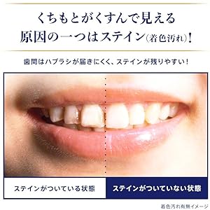 Amazon Ora2 オーラツー プレミアム クレンジングフロス 歯間美白 ミントフレーバー ワックス付き 40m Ora2 オーラツー 歯間クリーナー 通販