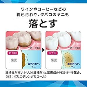 Amazon 医薬部外品 Settima セッチマ ホワイトニング 歯みがき デイリーケア ファインミントタイプ ステインケア タバコのヤニ取り フッ素配合 虫歯予防 80g Settima セッチマ ビューティー 通販