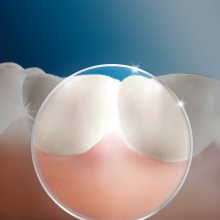 Limpieza suave para unas encías sanas