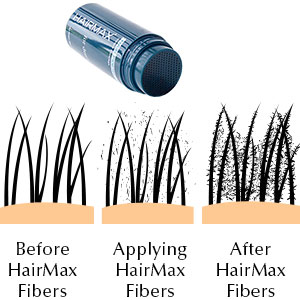 HairMax Fibers