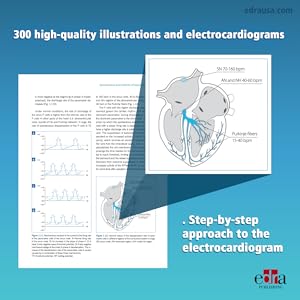 洋書 CARDIAC ARRHYTHMIAS in Dogs and Cats Amazon.com: Cardiac Arrhythmias in Dogs and Cats: Mechanisms