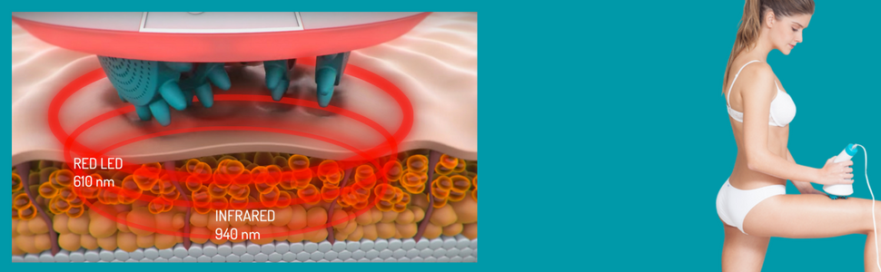 Cellulite Massagegerät – Glo910+ | Wirksam bei der Anti-Cellulite