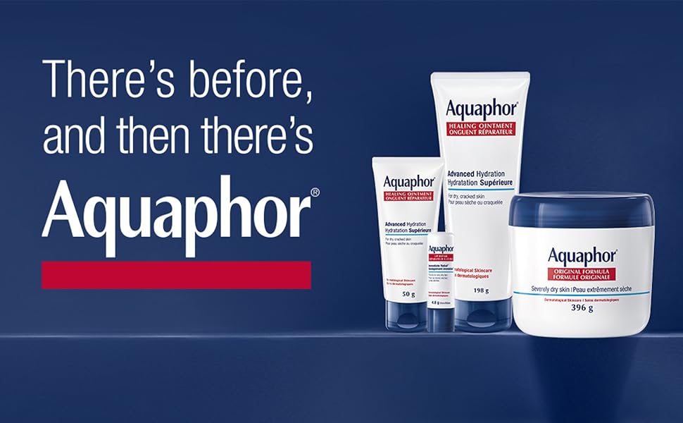IMAGE: There's before, and then there's Aquaphor