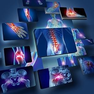 Curmin turmeric root healthy joint function protect cells and tissue by fighting free radicals