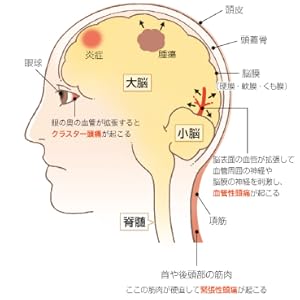 痛みをやわらげる科学 新装版 痛みの原因と予防法、そして最新